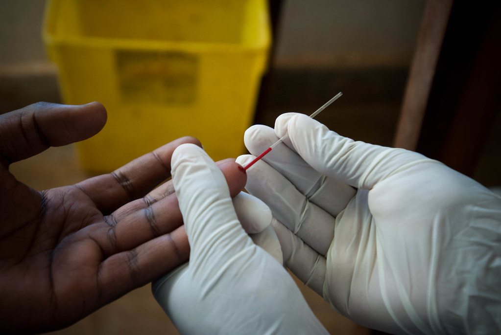 Rapid HIV test